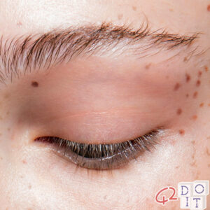 Freckles tattooed