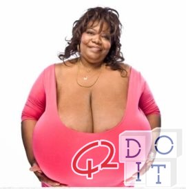 woman with the largest natural breasts in the world, Norma Stitz