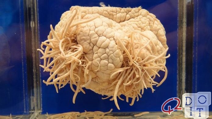 amoeba that eats the brain: what it is and why it kills