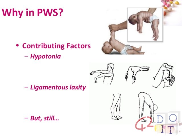 Prader-Willi, the rare genetic disease that makes people obese until they die: what they are, symptoms and treatment