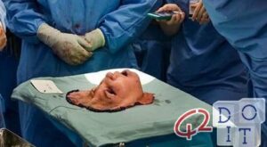 Facial transplant, 16 hours of operation at the Cleveland Clinic in Ohio