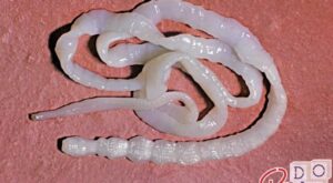 Tenia: how to take the solitary worm and how to treat it