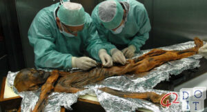 Ötzi, the frozen mummy of the Alps