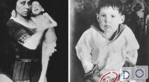 cure for diabetes, discovery of insulin and experimentation in 1922