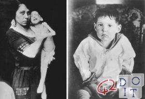 cure for diabetes, discovery of insulin and experimentation in 1922