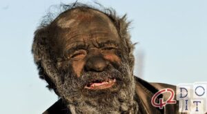 The dirtiest man in the world: he hasn’t washed for 60 years