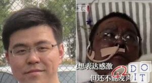 Coronavirus, infected Chinese doctors wake up from the coma with darker skin